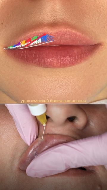 Увеличение губ в технике плоский бант