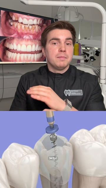 Премиум - это имплантация или сохранение своего зуба?