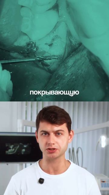 Протокол быстрого удаления зачатка зуба мудрости