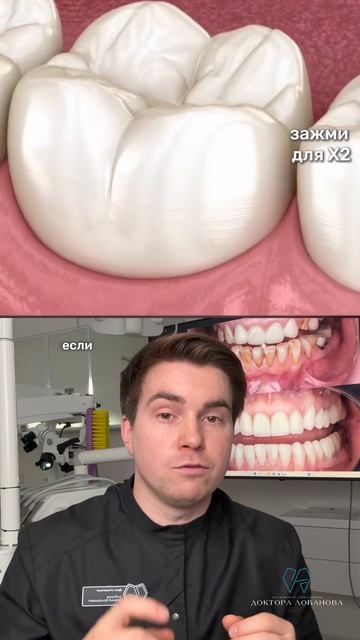 Что лучше сохранить зуб или поставить имплантат?