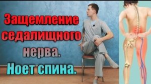 Защемление седалищного нерва. Ишиас. Прострел в ногу. Синдром грушевидной мышцы. Ноет спина.
