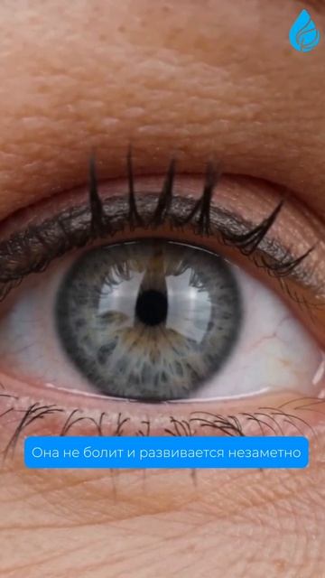 5 вопросов о глаукоме