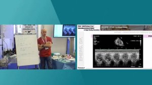 KNOCKING ON SEPSIS´ DOOR [Simulation Session]  ISICEM 45