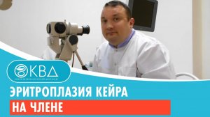 💣 Эритроплазия Кейра на члене. Клинический случай №190