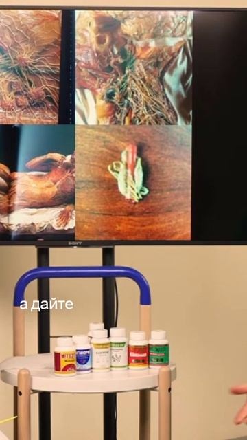 Мозг - Неизведанный центр нашего здоровья