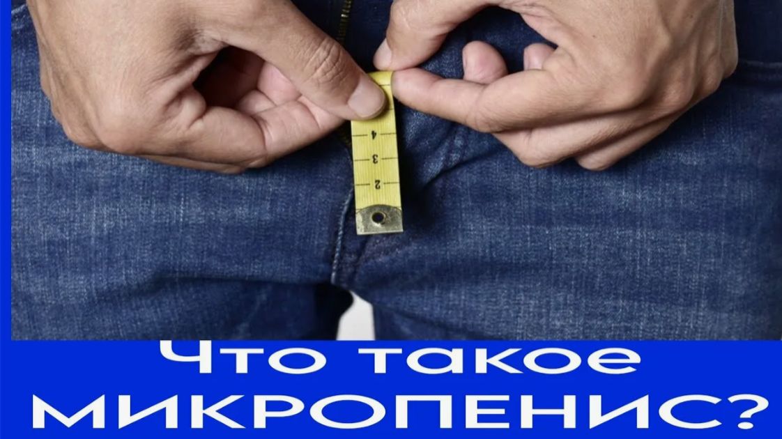 Микропенисы петербуржцев