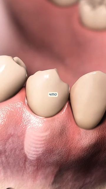 Эта технология позволяет вернуть зубы за 1 день