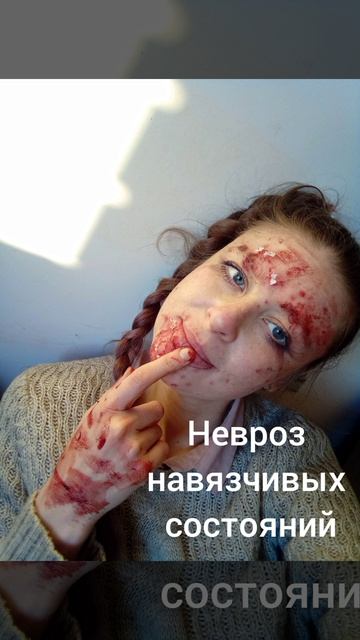 Дерматиломания