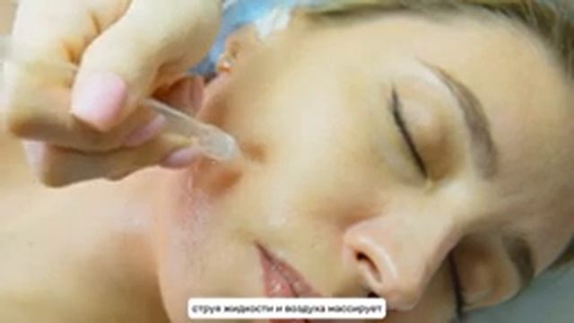 Избавляемся от отеков на лице. Процедура jet peel