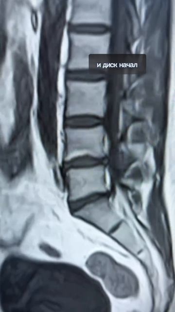 МРТ в травматологии и ортопедии