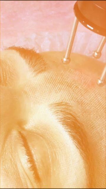 Лазерное омоложение на аппарате DermaBlate ASCLEPION - Клиника 