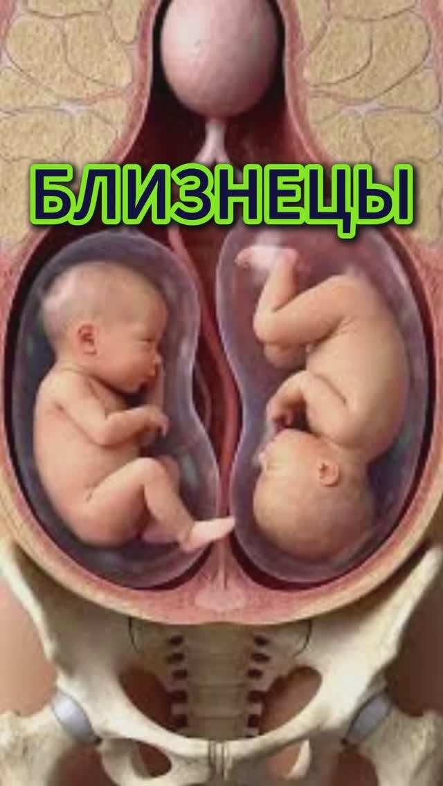 Близнецы
