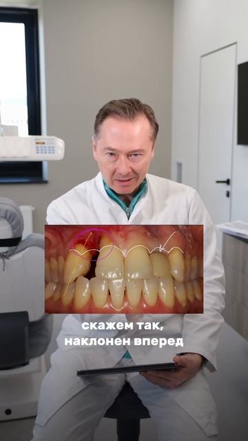 Смотрите видео на нашем канале #лечениезубов #зубы #стоматологмосква