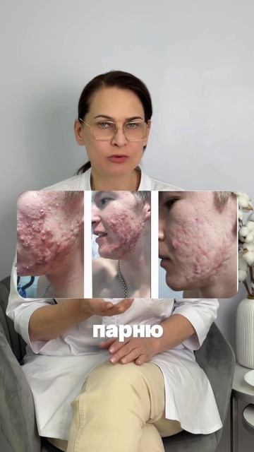 СТАВИМ ХОЛОДНОЙ ПЛАЗМЕ 0 ИЗ 10? 🥒