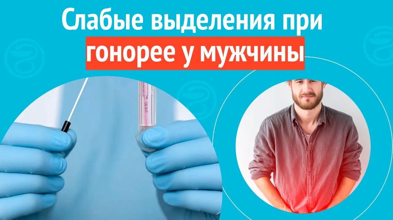  Слабые выделения при гонорее у мужчины. Клинический случай  1774