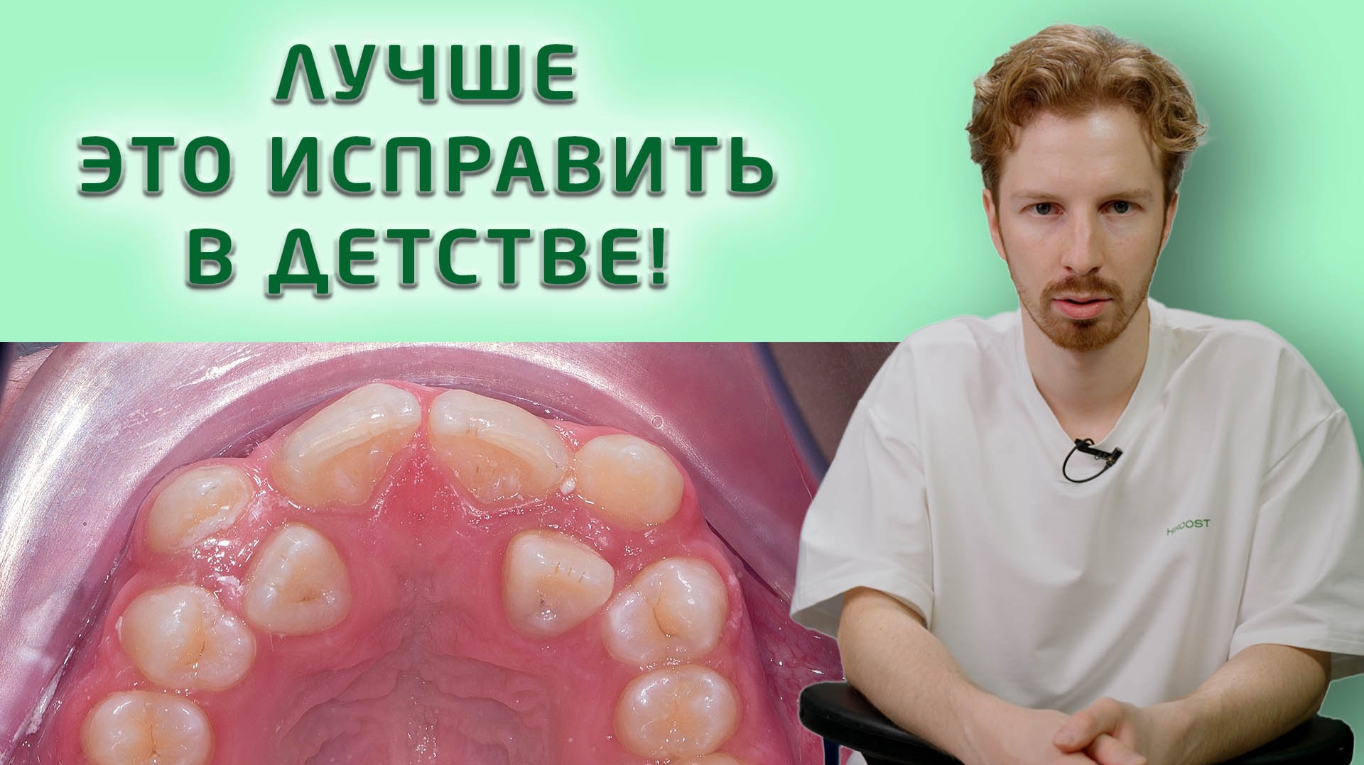 Если проблему кривых зубов оставить на потом, то во взрослом возрасте решить ее будет сложнее.