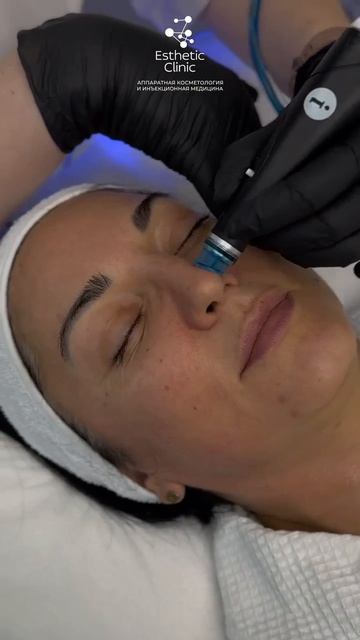 HYDRAFACIAL + БИОРЕВИТАЛИЗАЦИЯ💫