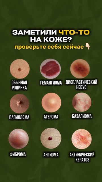 Что из этого опасно 👇🏻