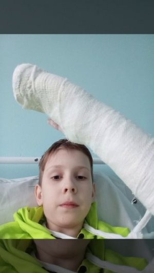 я руку сломал