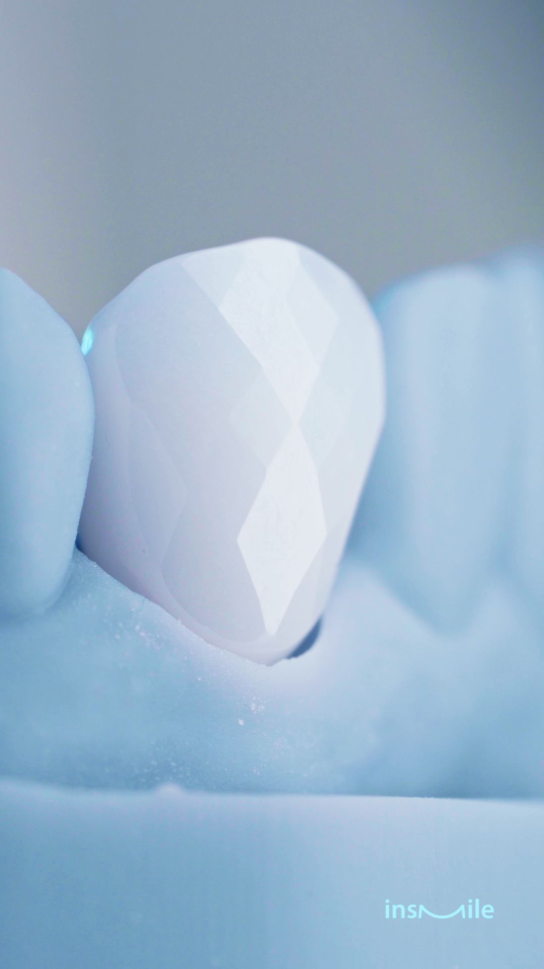 Виниры без обточки?