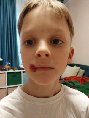 ура Бера дыра