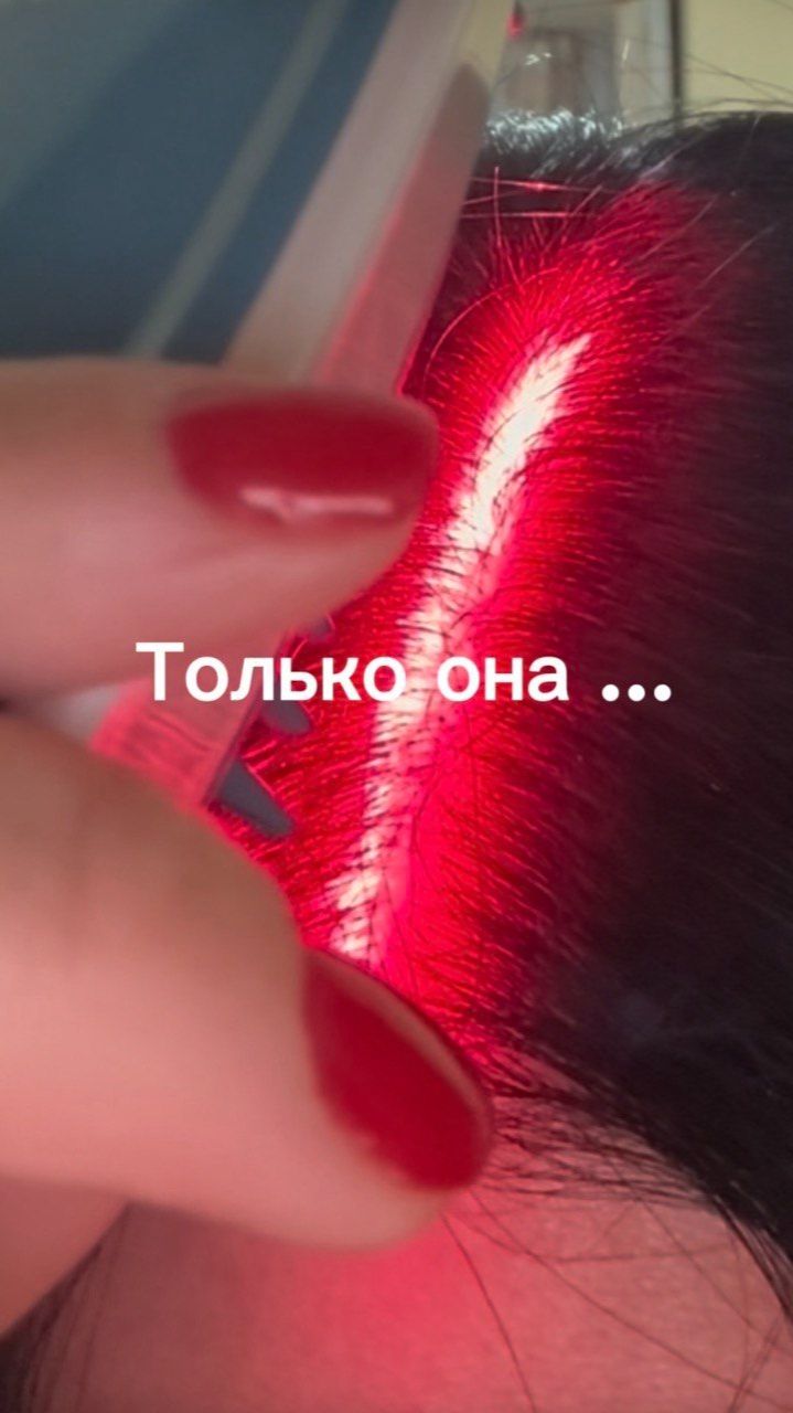 Лазер лечит алопецию (АГА) | alopecia.hair