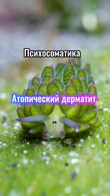 Психосоматика дерматита #германскаяноваямедицина #гнм #психолог #психосоматика