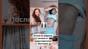 Цирроз Нано бальзам 89177396793 консультация приобретения Глобал Тренд