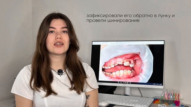 Интересный клинический случай🦷