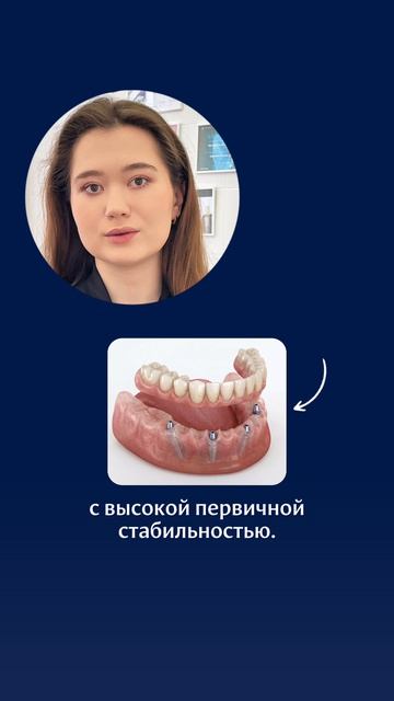 Страх неприживления имплантов