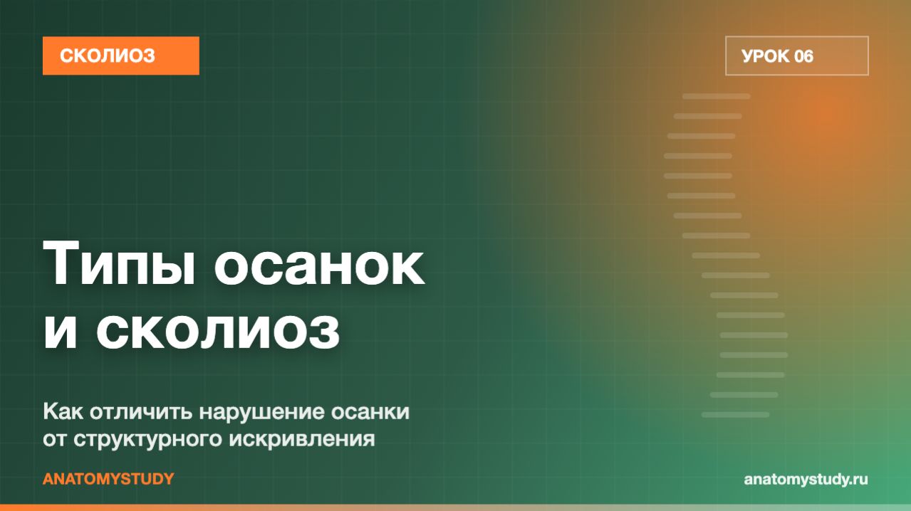 Типы осанок и сколиоз: как отличить нарушение осанки от искривления