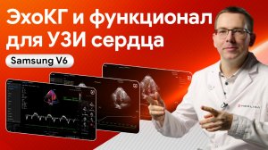 Эхокардиографическое исследование на Samsung V6 и разбор опций для УЗИ сердца