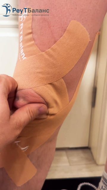 Тейпирование колена