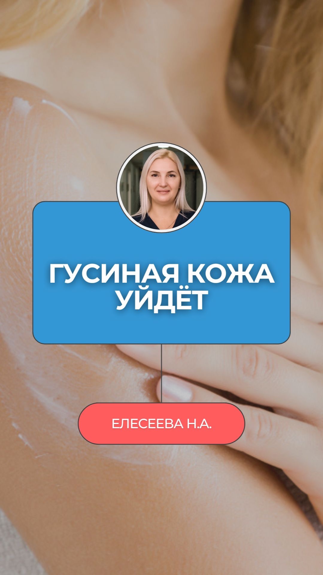  Эти пупырышки на руках  не аллергия. И скраб не поможет.