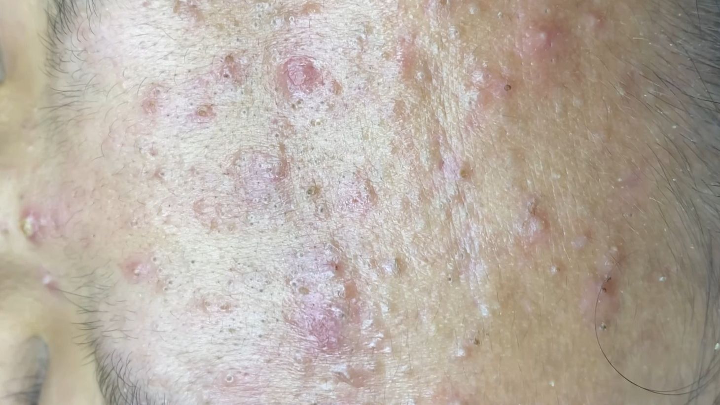 Выдавливание 