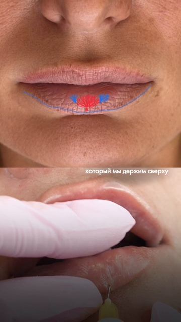 Увеличение нижней губы