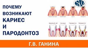 Почему возникает кариес и пародонтоз