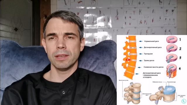 Почему болит поясница. Миопрессура мышц