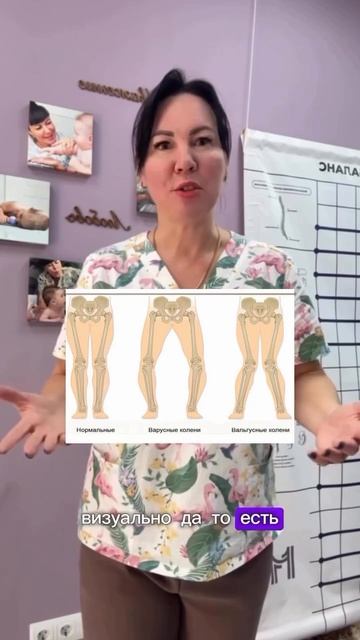 Вальгус до 7 лет не лечится🔻