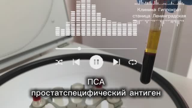ПСА: простатоспецифический антиген в клинике Гиппократ станица Ленинградская