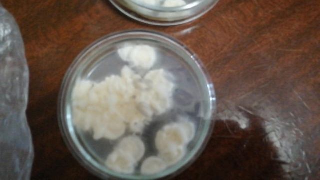 Боверия и треходерма в одной чаши петри, косяк..