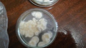 Боверия и треходерма в одной чаши петри, косяк..