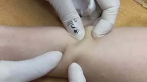 103 • Acne collection • АСМР • Relax Spa