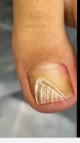 Испортила ногти на работе