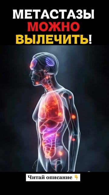 Метастазы можно вылечить