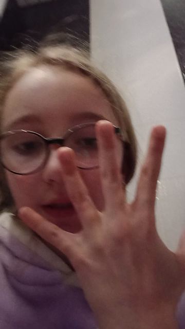 Варя вывихнула палец? 😱😱😱😱😱