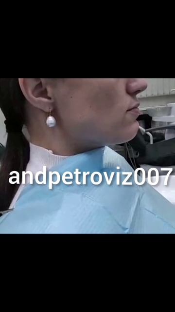 ! Расслабляющий коплект шин (кап) при подвывихе нижней челюсти.