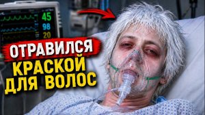 ОТРАВИЛСЯ КРАСКОЙ КОГДА КРАСИЛ ВОЛОСЫ И ПОХОЖЕ ВОЗВРАЩАЮСЬ В НЕБЫТИЕ. АЛЛЕРГИЯ НА КРАСКУ ДЛЯ ВОЛОС