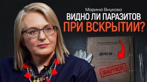 Эпидемия глистов? Как люди заражаются — и не замечают? ВНУКОВА | КОПАНЦЕВ