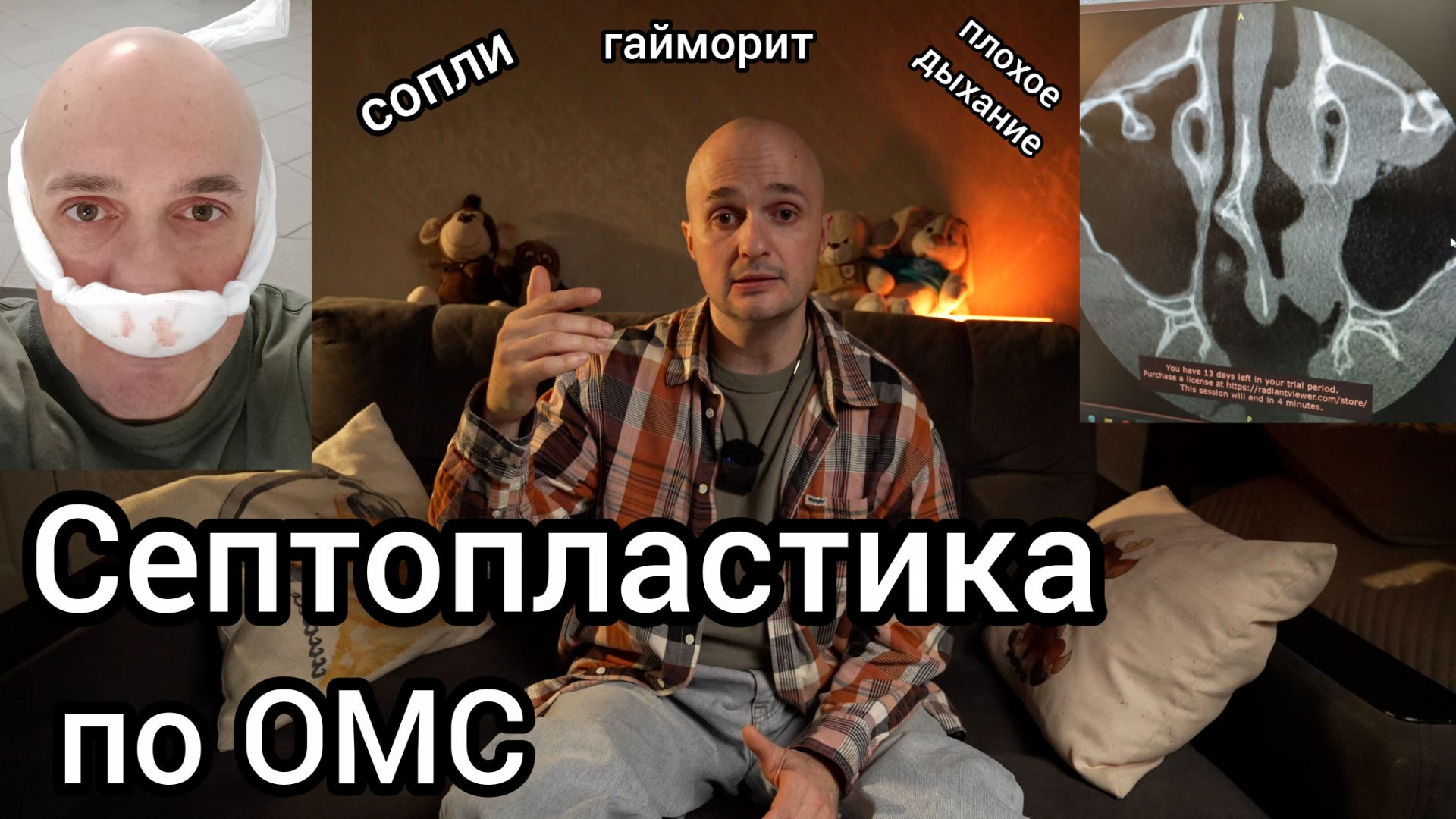 Септопластика. Исправление искривленной перегородки.